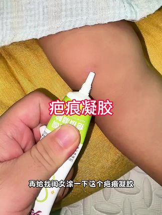 孩子难免磕磕碰碰留下印子,这个膏真的要备上,认准#医用硅酮 是关键。#疤痕凝胶 #宝宝护理