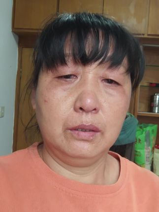 @@大家好我是江凯凯妈妈,前天晚上说不昰没租到房子吗,今天租了一间60元一天的房子,我没和凯凯讲一个人租的,我说两个人合租的,我怕他在院里但心,没有办法,非常感谢在这边的几位老乡都过来看凯凯,也非常感谢所有的好心人和爱心人士的关心和帮助,大病无情,人间有爱,祝好人一生平平安安,一生健健康康,一路长虹