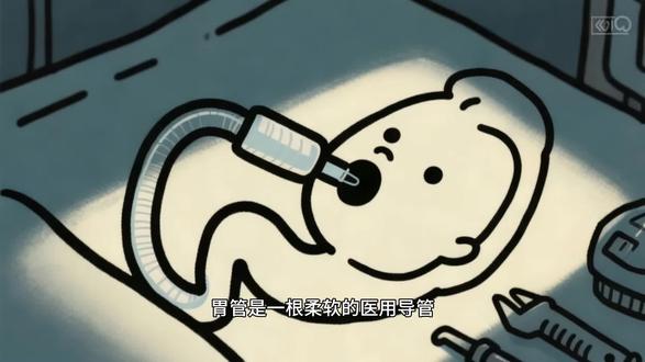 #医学科普 #胃病患者日常生活 #胃管 #胃管食管反流性食道炎 进食困难的患者,医院中用到的胃管究竟是什么,可以了解一下