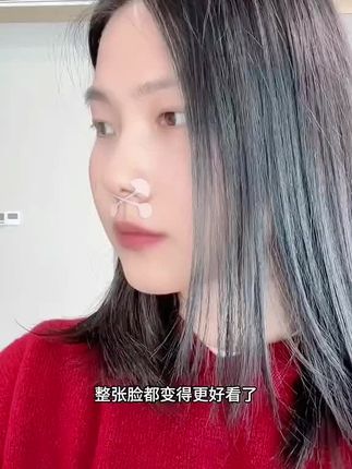跟着#张予曦 贴#小哑铃鼻翼贴 每晚睡前贴一下,什么大蒜鼻,宽鼻翼都能变窄,无痛变美真的绝绝子!#鼻翼缩小 #鼻翼贴 #变美小技巧