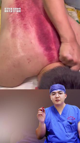 身体出现这三种后背疼痛,要警惕可能是癌症的征兆 #抖出健康知识宝藏 #医学科普 #涨知识 #热点 #健康科普破圈计划