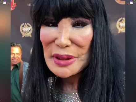 #狙击蝴蝶开播 如果不是亲眼所见,谁敢相信医美四巨头被公开处刑竟如此尴尬。#刘晓庆 常年以冻龄神话自居,不料反复题拉,导致她的耳垂逐年下垂至嘴角,做大表情时面部肌肉如橡皮般僵硬。然而更令人唏嘘的是邵音音,这位曾被李小龙钦点的瓷娃娃,为挽回婚姻在下巴注入廉价硅胶,一次意外摔伤导致填充物移位,面容扭曲肿胀,用一张破碎的脸诠释着整容的反噬。最讽刺的是萧蔷,昔日的台湾第一美女,为维持容颜注射过量玻尿酸,导致苹果肌膨隆如寿星公,微笑时嘴角机械上扬却不达眼底,昔日灵动的眼神消失无踪,难怪近两年女明星们,集体都在抛弃馒化手段,追求自然灵动美,颖宝从发腮疲态脸到精致建模脸,杨幂从原来的显老横秋,到如今的少女感满满,还有蒋欣被嘲松弛的脸,到现在抬眼都是明眸桃花相,她们究竟是怎么做到越老越年轻的,而其中的代表人物韦雪,无疑是最成功的,年近40 岁,却比20岁的自己更显年轻态,而韦雪也是毫不吝啬的 ,在直播间分享了女明星,惊艳回春的秘诀#韦雪 #好物推荐 #眼膜