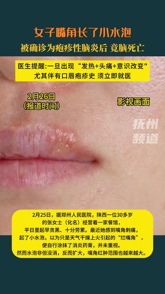 2月25日,据郑州人民医院,陕西一位30多岁的张女士(化名)经营着一家餐馆,平日里起早贪黑、十分劳累。最近她感到嘴角刺痛,起了小水泡,以为只是天气干燥上火引起的“烂嘴角”,便自行涂抹了消炎药膏,并未重视。然而水泡非但没消,反而扩大,嘴角红肿范围也越来越大。
婆婆找来凉茶等土方,张女士喝后依然没有改善,甚至脸颊周围出现麻木感。随后张女士开始高烧、浑身无力,关店后买了退烧药服用。当晚她嘴角的伤口也越发红肿,还有强烈的呕吐反应。家人见情况危急,急忙送医。
经检查,她并非普通发热,而是已发展为严重感染。进一步脑部及血液检查后,确诊为疱疹性脑炎——最初嘴角的小水泡,正是由单纯疱疹病毒引起。由于病毒已侵犯中枢神经系统,导致脑组织严重水肿与炎症,张女士最终因大脑衰竭不幸被宣告脑死亡。
郑州人民医院皮肤科主任李天举指出,单纯疱疹病毒分为1型与2型,人是唯一宿主。感染后病毒终身潜伏,免疫力下降时可复发,可能引起皮肤黏膜疱疹、角膜炎、脑炎等,目前无法根治,治疗以抗病毒为主。多数感染者症状轻微或无症状,仅极少数会像张女士一样发展至严重脑炎。医生提醒:一旦出现“发热+头痛+意识改变”,尤其伴有口唇疱疹史,须立即就医。