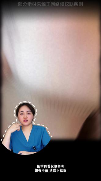 下颌线提升有哪些项目可以选择? #下颌线 #提升 #抗衰老 #医疗美容 #面部年轻化