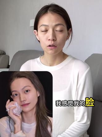 “充气感”才是幼态脸成功的精髓 #变美 #幼态脸 #微调 #变美逆袭 #年前变美计划