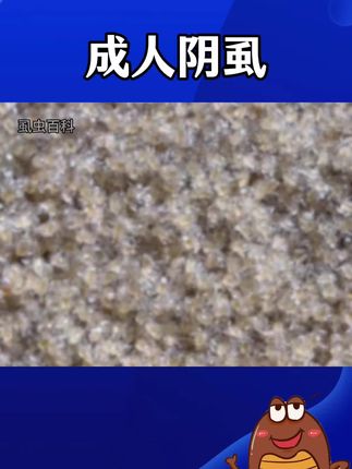 【保密发货】男女阴虱,瘙痒不断,阴虱克星,百部酊喷剂 #阴虱 #阴虱喷雾剂 #男性阴虱 #百部酊喷剂