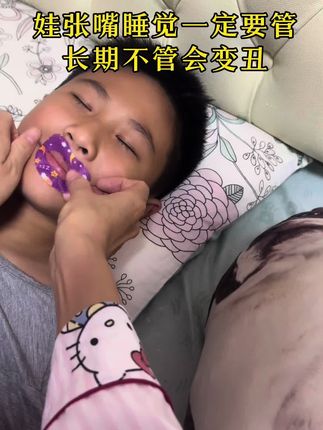 张嘴呼吸真的会影响颜值,这个闭口贴给娃用起来。#张嘴呼吸 #张嘴呼吸会变丑 #嘴贴矫正贴儿童