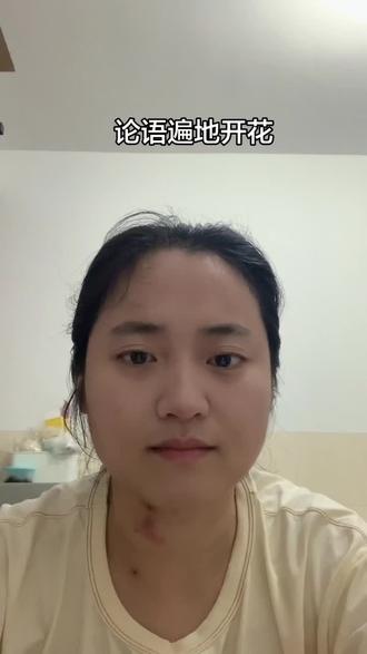 二十一,子曰:"不得中行而与之,必也狂狷"(juan)乎!狂者进取,狷者有所不为也。"
今译
孔子说:"找不到言行都合理的人在一起,只好找次一
等的狂狷的人了!狂放的人虽然好高骛远,但有进取心,狷介的人拘谨保守,但不会做出不合理的事。"
引述
狂妄的人,看起来骄傲自大,却往往敢作敢当,勇于进取。狷介的人,虽然拘谨保守,却能够顾虑周全。一般来说,年轻人近于狂妄,而年纪大的人,则近于狷介。过度积极进取或过分保守谨慎的狂狷人士,当然比不上言行都能够恰到好处的中道人士。但是在找不到适当的对象时,就算退而求其次,也是不得已的选择。
生活智慧
(一)中行是言行都恰到好处的表现,无过与不及,"度"的掌握十分准确,当然非常难得,十分不容易找到。
(二)狂妄或狷介,虽然各有缺失,却也各有优点。我们看人,最好多看优点,少看缺失。狂狷的人,透过各自的优点,仍然可以弘扬大道。
(三)自古以来,有志于道而又品德高尚的,实在少之又少。狂狷人士,虽然没有中和的德性,毕竟各有优点,仍然是可以造就的人才。
内部