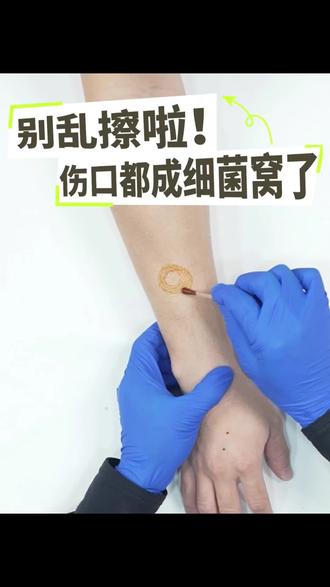 别再盲目消毒了!改掉碘伏棉签的常见误区,掌握正确消毒方法,告别伤口红肿发炎,居家实用小技巧get✅#碘伏消毒#伤口护理小知识#居家实用技巧#日常健康防护#生活急救常识