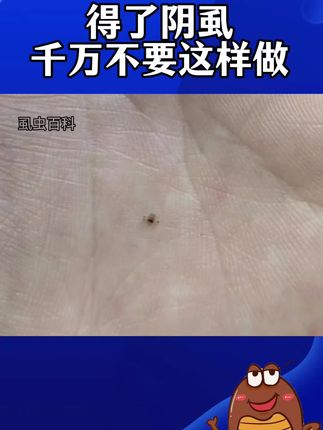 【保密发货】男女阴虱,儿童头虱,成分温和#头虱#阴虱喷雾剂 #仁和复方百部酊喷剂 #阴虱