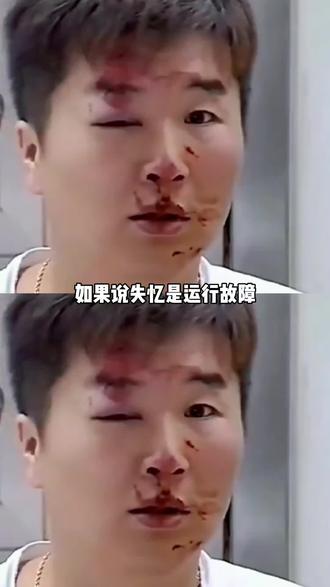 即使我失去记忆,身体也会比我先做出反应去爱你。#急诊室故事#爱情#本能#情感#真实事件