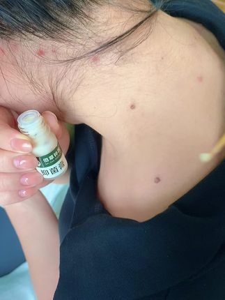 #好物推荐🔥 #脖子上的小肉粒 #一家不错的店