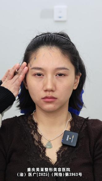 皮肤问题的姐妹看过来咯 #重庆美容 #重庆整形 #重庆美莱