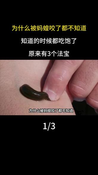 为什么被蚂蝗咬了都不知道,知道的时候都吃饱了,原来有3个法宝