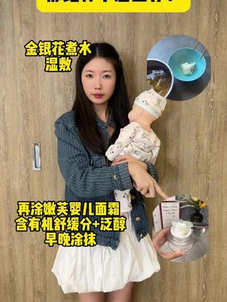 宝宝小脸红痒干怎么办!#婴儿护理 #婴儿面霜 #嫩芙婴儿面霜 #宝宝