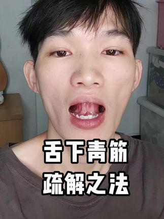 舌下有青筋的跟着我做,早晚100~200下。坚持半个月到一个月,会有惊喜的,原理给你讲的明明白白。#养生
