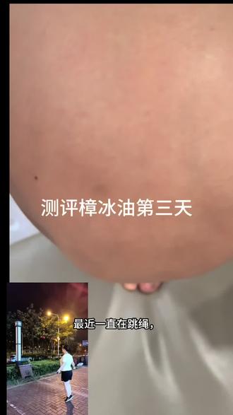 神油一樟冰油#消肿#驱蚊#防晕车