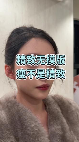 不是瘦了就精致,过度瘦反而变丑了#减肥 #精致 #暴瘦 #面部状态