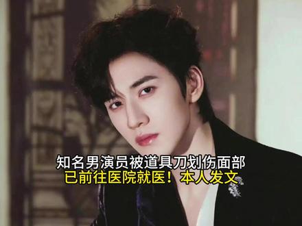知名男演员被道具刀划伤面部,已前往医院就医!本人发文 #抖音全民写作大赛