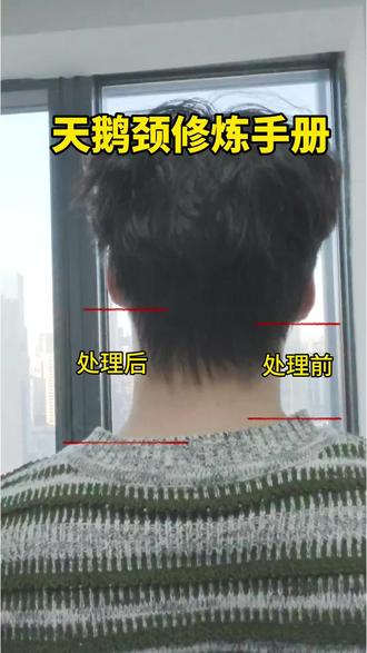 头前伸、富贵包、脖子短粗,不是天生的,是肌肉紧张+体态问题!每天跟着练,放松紧张肌、激活弱肌,脖子自然显长、体态更挺拔~#脖子变长 #天鹅颈训练 #头前伸矫正 #富贵包改善 #美女