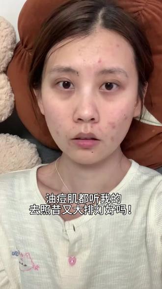 为什么现在才挖到!妥妥油痘肌救星,快试试昔又新经典大排灯~ #昔又大排灯