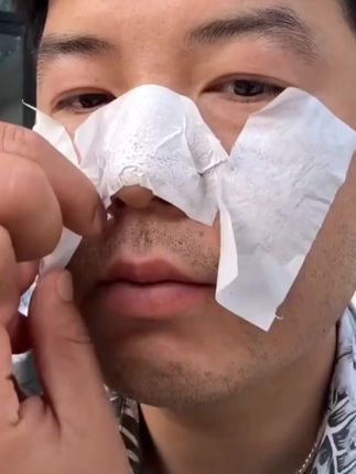 泰国white芦荟胶去黑头鼻贴祛黑头粉刺闭口导出液收缩毛孔男女#女生必备#黑头 粉刺说拜拜#黑头#黑头鼻贴#强烈推荐