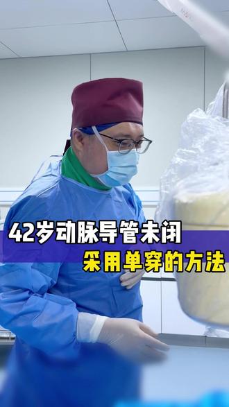 42岁的动脉导管未闭,采用单穿的方法伤口小#河北医科大学第一医院马杰主任 #卵圆孔未闭微创马杰主任 #头疼 #头晕 #先心病