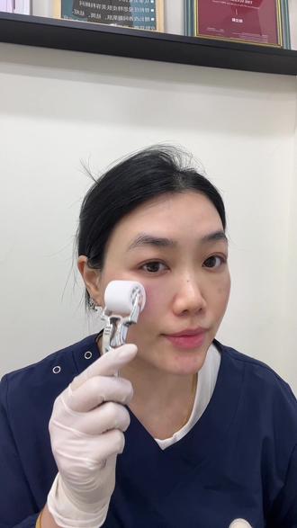 自己在家就能做的美白滚z,提亮肤色,改善黄褐斑、痘印、色素沉着。#美白淡斑 #提亮肤色 #可溶性滚针 #护肤 #郴州美容