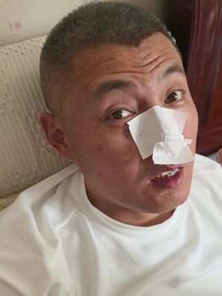 去黑头的简直太好用了,真的极力推荐姐妹们用!男女通用的去黑头神器,黑头粉刺多的赶紧用起来!#去黑头 #清洁 #面包护理