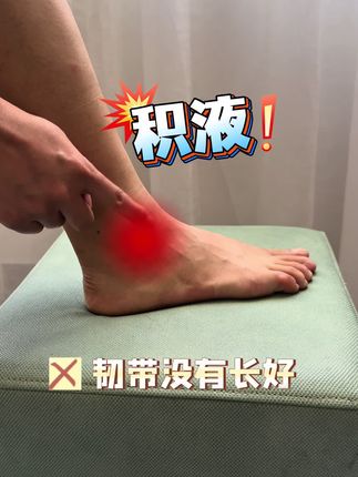 脚踝还没恢复好,需要佩戴护踝保护才更好的防止二次损伤#崴脚 #踝关节扭伤 #护踝防崴脚 #踝关节康复 #护踝