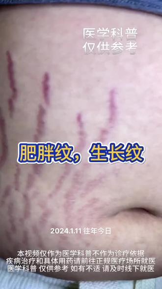 生长纹是这样的 #硬核健康科普行动