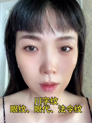 一款胶原美容绷带贴,每天晚上贴、早上揭,让你睡梦中变美!#川字纹 #眼纹 #眼袋 #法令纹#好物种草