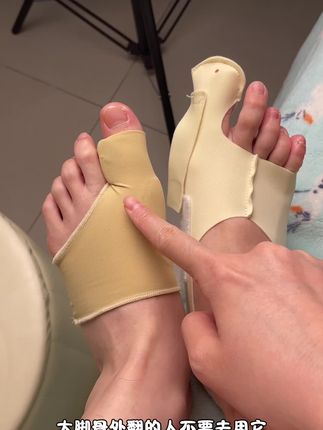 #拇外翻 #大脚骨