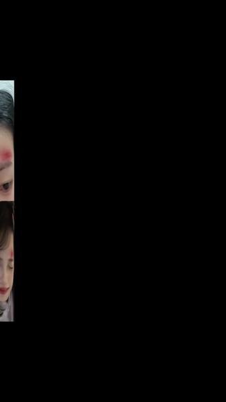 #额头磕伤 #擦伤妆 #擦伤妆ai指令 额头受伤豆包指令教程 额头擦伤妆特效ai指令教程 额头擦伤特效ai指令 脸部擦伤特效ai生成#剪映 #剪映图片设计 额头擦伤妆ai生成 额头受伤特效ai指令 额头受伤p图指令 额头擦伤ai生成指令 额头擦伤特效p图教程