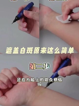 盖百霖修饰型白斑即时遮盖笔(这款不防水,临时使用,补涂使用)修饰