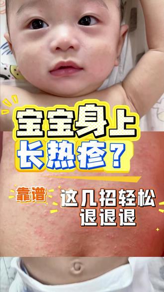 小宝宝身上长#热疹?用这几个办法热疹退退退!宝宝真的超怕热,家长们平时真的没必要给宝宝穿那么多~#宝宝护理#育儿经验分享