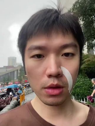 #法令纹贴 #法令纹 #鱼尾纹 #川字纹 #抬头纹