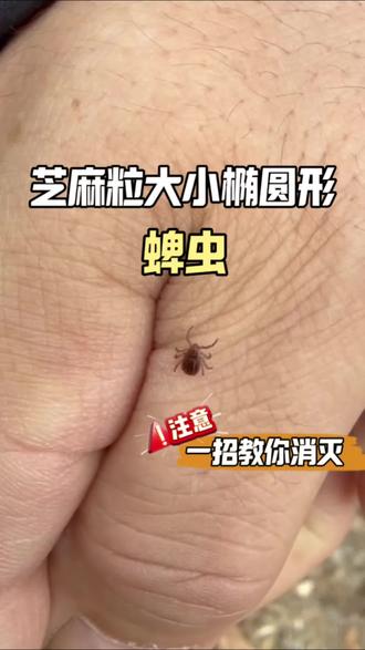 蜱虫长什么样?蜱虫咬的包又是长什么样?这个芝麻粒大小,椭圆形,有8条腿的小虫,它就是蜱虫,没吸血时干瘪发黑,吸食血液后身体迅速膨胀,这是蜱虫口器刺入留下的痕迹。刚被咬时不痛不痒,数日后被叮咬处慢慢红肿发硬,如果是携带病菌的蜱虫,伤口周边会生出一圈圈环状红斑,向外不断扩散。吃饱喝足后的蜱虫会藏在床垫、衣柜角落和踢脚线等区域大量的繁殖产卵,温度适宜,两到四周虫卵就会孵化,会持续危害家庭,蜱虫要怎么彻底消灭呢?推荐使用这款蜱虫杀虫剂,喷洒在虫子常出现和躲藏的区域,就可以有效的完成虫卵双杀的效果,这款杀虫剂是无色无味的,孕婴宠家庭放心使用#蜱虫 #蜱虫叮咬切勿生拉硬拽 #蜱虫杀虫剂 #蜱虫的危害 #蜱虫叮咬