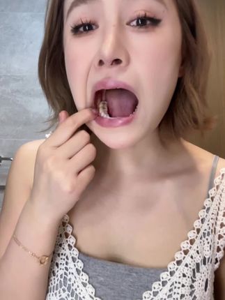 金盾第五代三面牙刷,真的太好用了,后槽牙智齿都刷得干干净净的。#三面牙刷#巨无霸三面牙刷#软毛牙刷#牙齿清洁 #种草