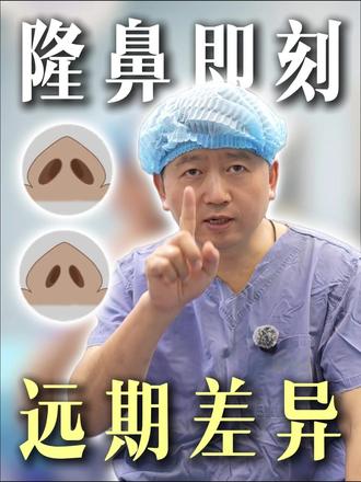 常有姐妹问:隆鼻刚做完和恢复好差别大吗? 贺博28年经验说——当然大!
刚做完受麻药、肿胀影响,皮肤薄可能掩盖问题,厚则显宽,恢复后更精致。
侧面山根消肿会低些,鼻唇角麻药退了更自然。
贺博结构派骨相鼻,T支架+十字交叉缝合,稳、自然、持久。
#隆鼻即刻远期 #南京隆鼻 #肋软骨隆鼻 #鼻整形避坑 #贺小虎