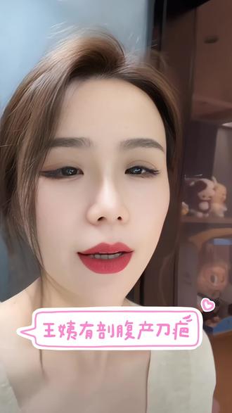 天塌了兄弟们,王姨不仅结过婚还有剖腹产刀疤#一般人不告诉他 #这是个真实的事情