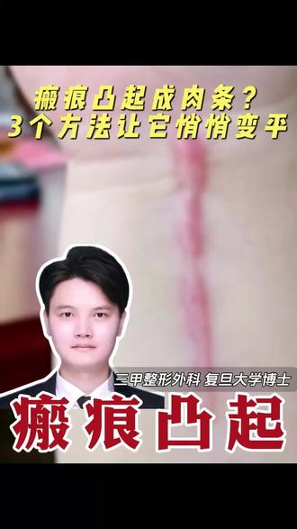 疤痕增生后还能变平吗?三个方分享给你#疤痕 #疤痕增生 #疤痕疙瘩 #护理 #疤痕凸起