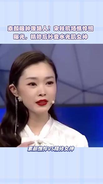 素颜眼肿像路人! 宋轶机场憔悴照曝光,精修后秒变水光肌女神 #宋轶 #白敬亭宋轶 #宋轶气质绝了 #素颜 #女神