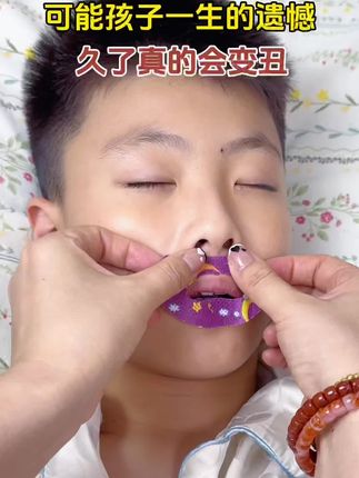 等嘴凸了就晚了!#张嘴呼吸会变丑 #张口呼吸的危害