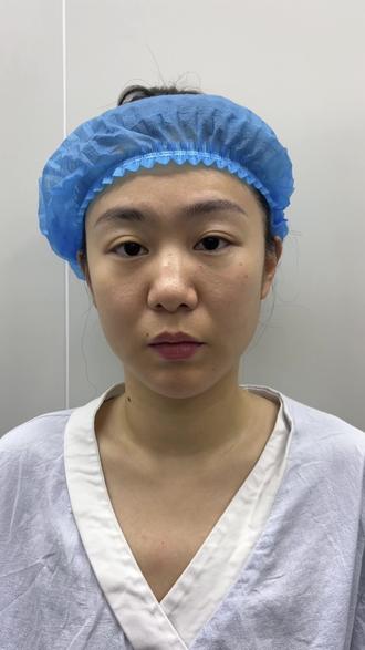 私人定制仅供参考#术前术后