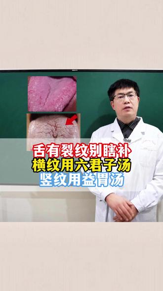 裂纹舌别瞎补 #舌象