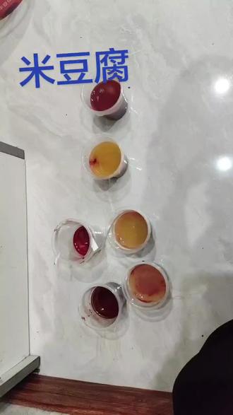 健康的人为何要定期刺血
通过现代研究和大量的临床验证已发现:正常人适当的刺血——可以稀释血液浓度,直接达到祛瘀的目的,淤血一旦去除,血液浓度正常,这自然就可以降低血脂,血糖和血压,且能起到预防脑中风,心肌梗死。适当的刺血_——还可以改善微循环,使原本因末梢循环不畅而造成的四肢冰冷症得到改善;让因劳损、外伤或感受风寒而引起的颈、背、腰部的气血瘀滞的经络系统得到疏通而消除疼痛酸胀。