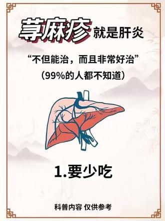 教你摆脱荨麻疹小技巧#荨麻疹#荨麻疹结束了