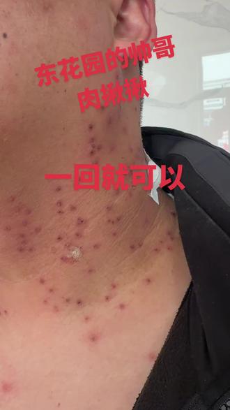 怀来的帅哥来找我做了一脖子的肉啾啾一回就好,#上热搜 #同城好店推荐