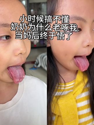 原来老人的啄啄啄都是有原因的,当妈后才知道朱雀三啄,不得不服#朱雀三啄 #小动作大作用 #贵在坚持 #小工具大用途